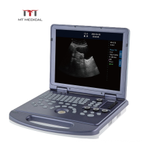 Ultrasound manufacturing clear Imaging portable laptop ultrasound scanner machine price